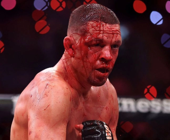 네이트 디아즈 UFC 레전드 맞아? 처참했던 복귀전